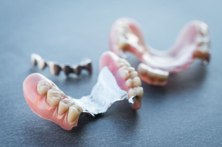 The Pros and Cons of Metal Partial Dentures, Explained